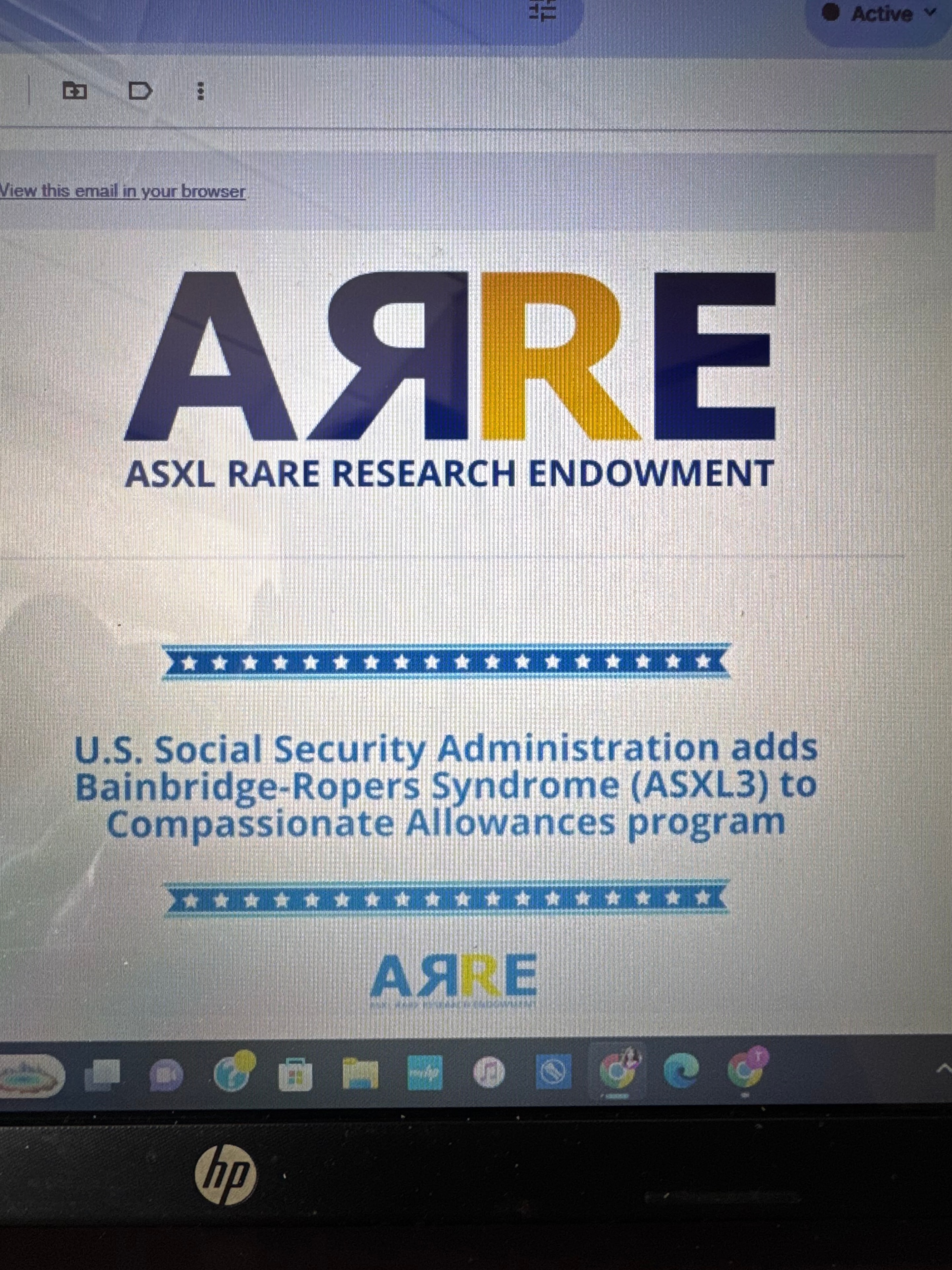 Social Security adds Bainbridge-Ropers Syndrome to Compassionate Allowances